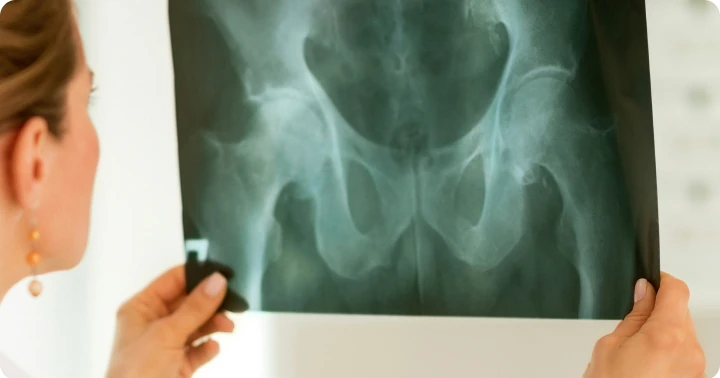 Mobile X-ray for falls and injury checks