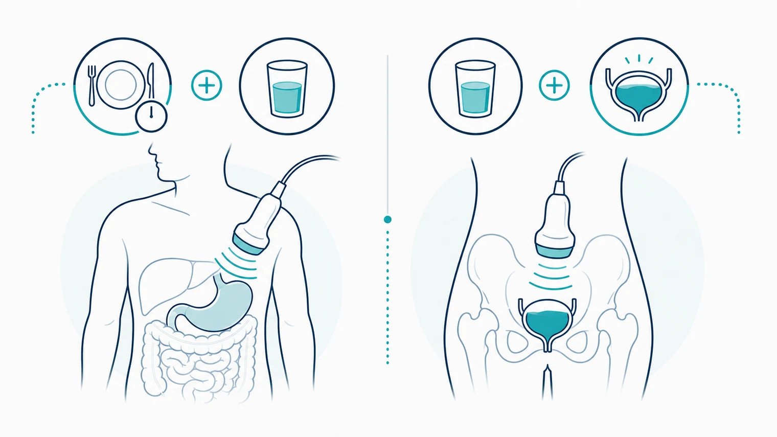 Schematic ultrasound preparation image showing fasting, water and bladder preparation paths